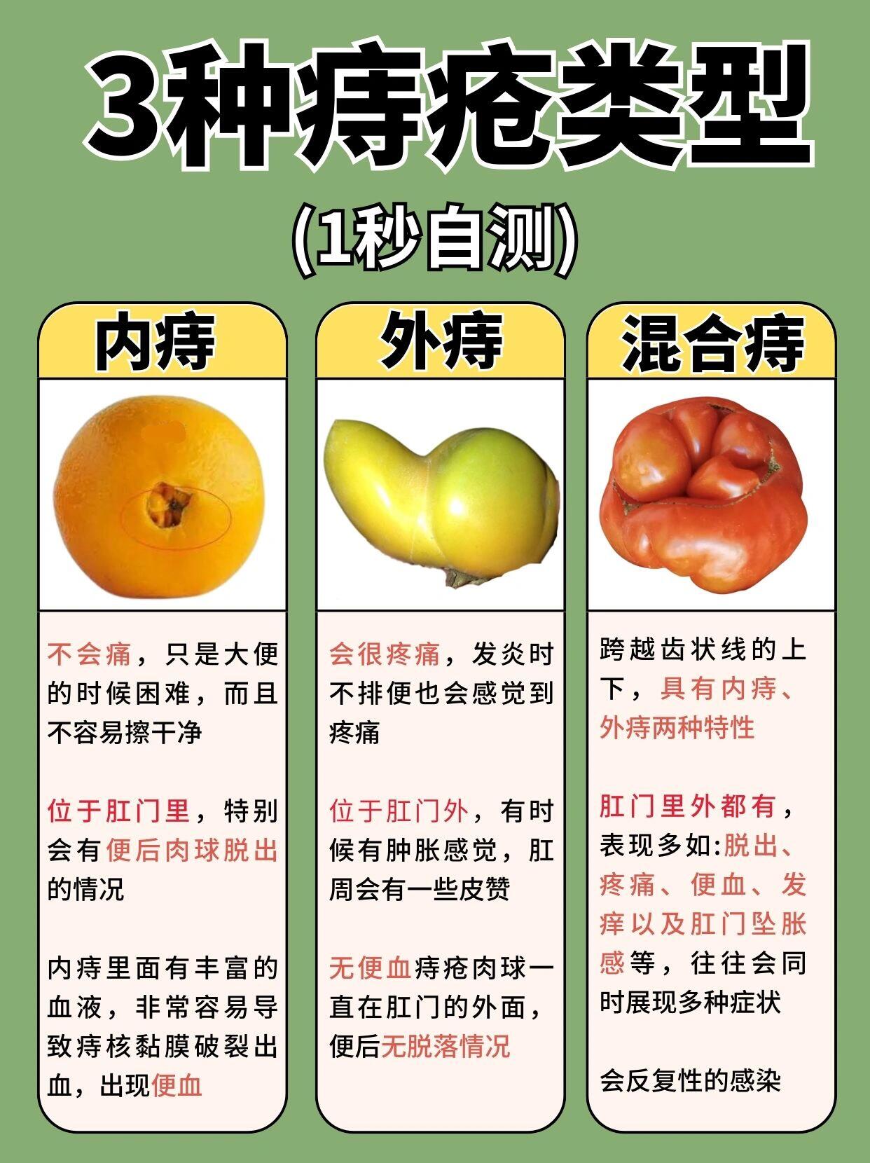 快来对照一下:你到底是哪种痔疮别搞错了