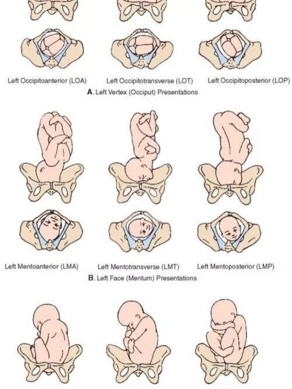 相信你的宝宝~ 	 30周检查的时候从头位变成臀位,心情很郁闷.
