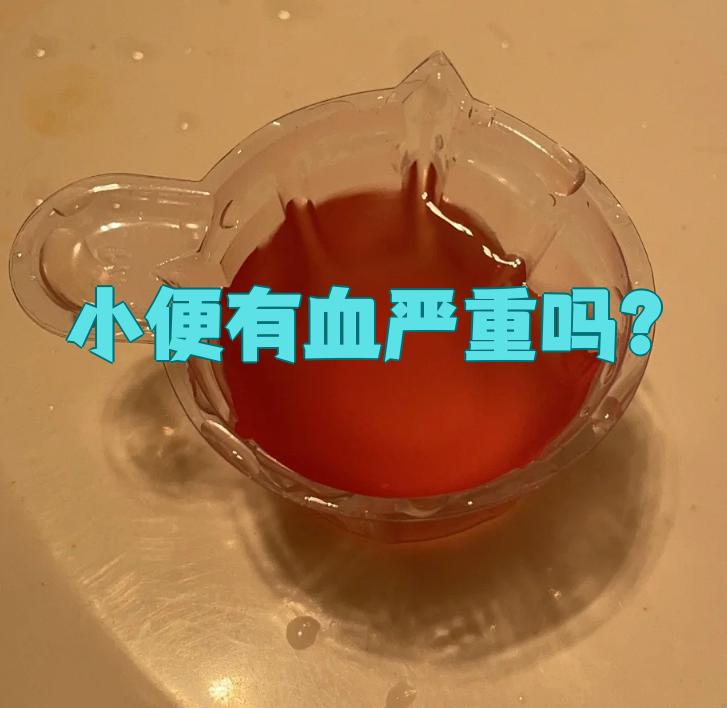 为什么拉的尿是红色的