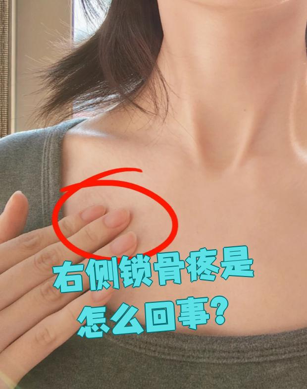 比如摔倒或者被撞到,锁骨受到直接撞击就可能骨折