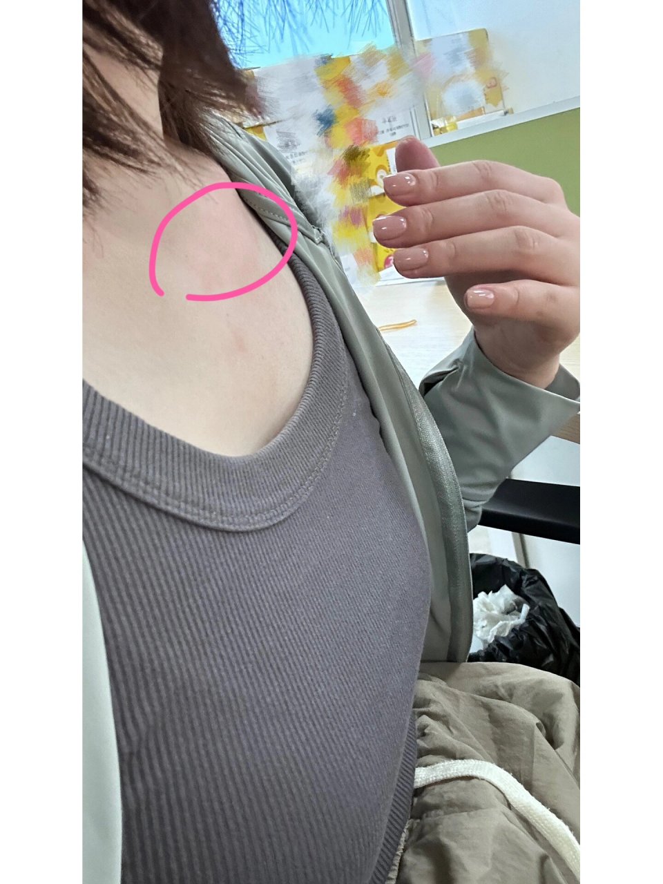 右边锁骨下面突然凸起了一块 右边锁骨下突然凸起一块,不痛不痒,这是