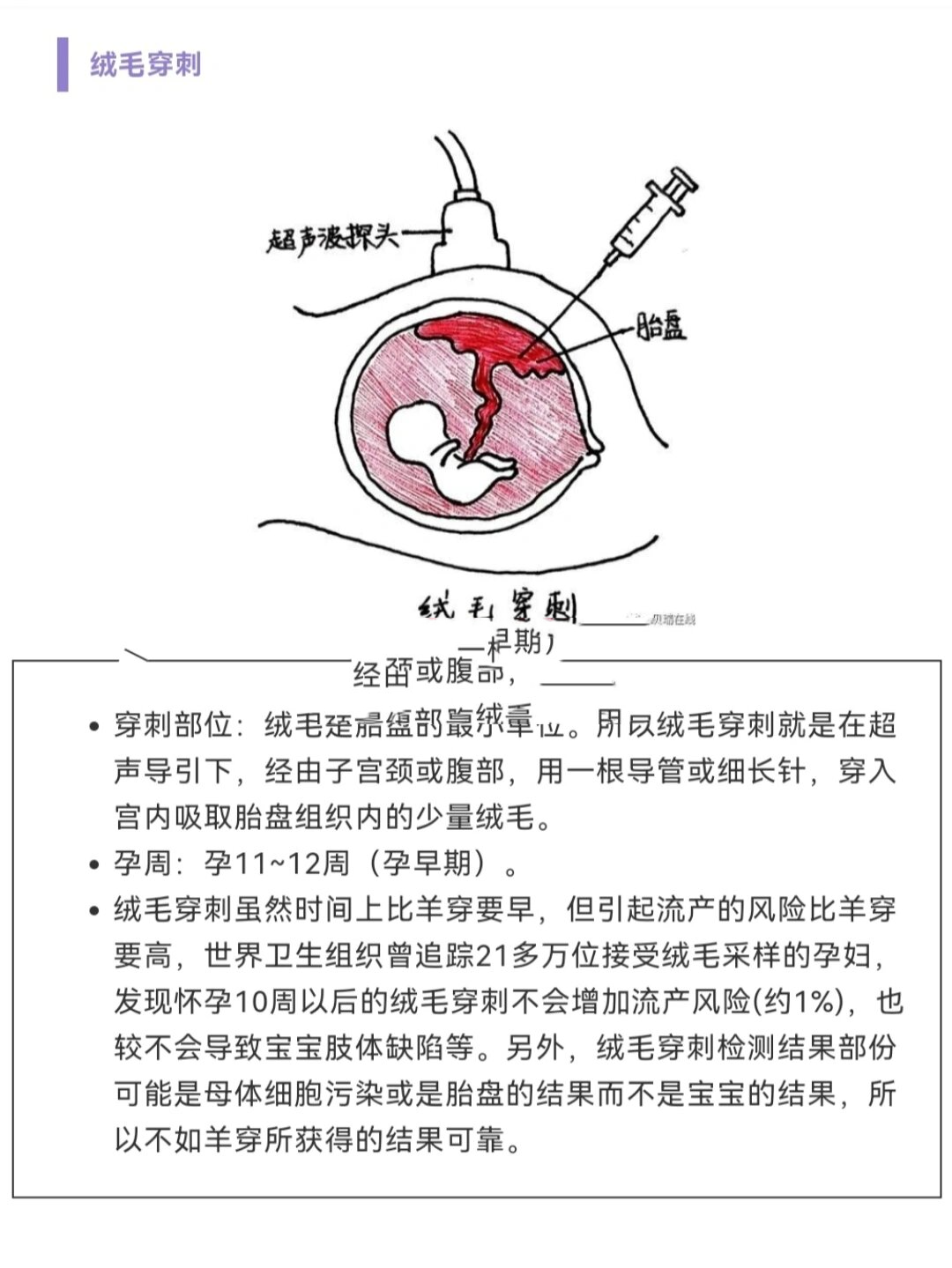 产检之羊水穿刺,绒毛穿刺,脐带血穿刺区别 产检的时候,如果唐筛,无创