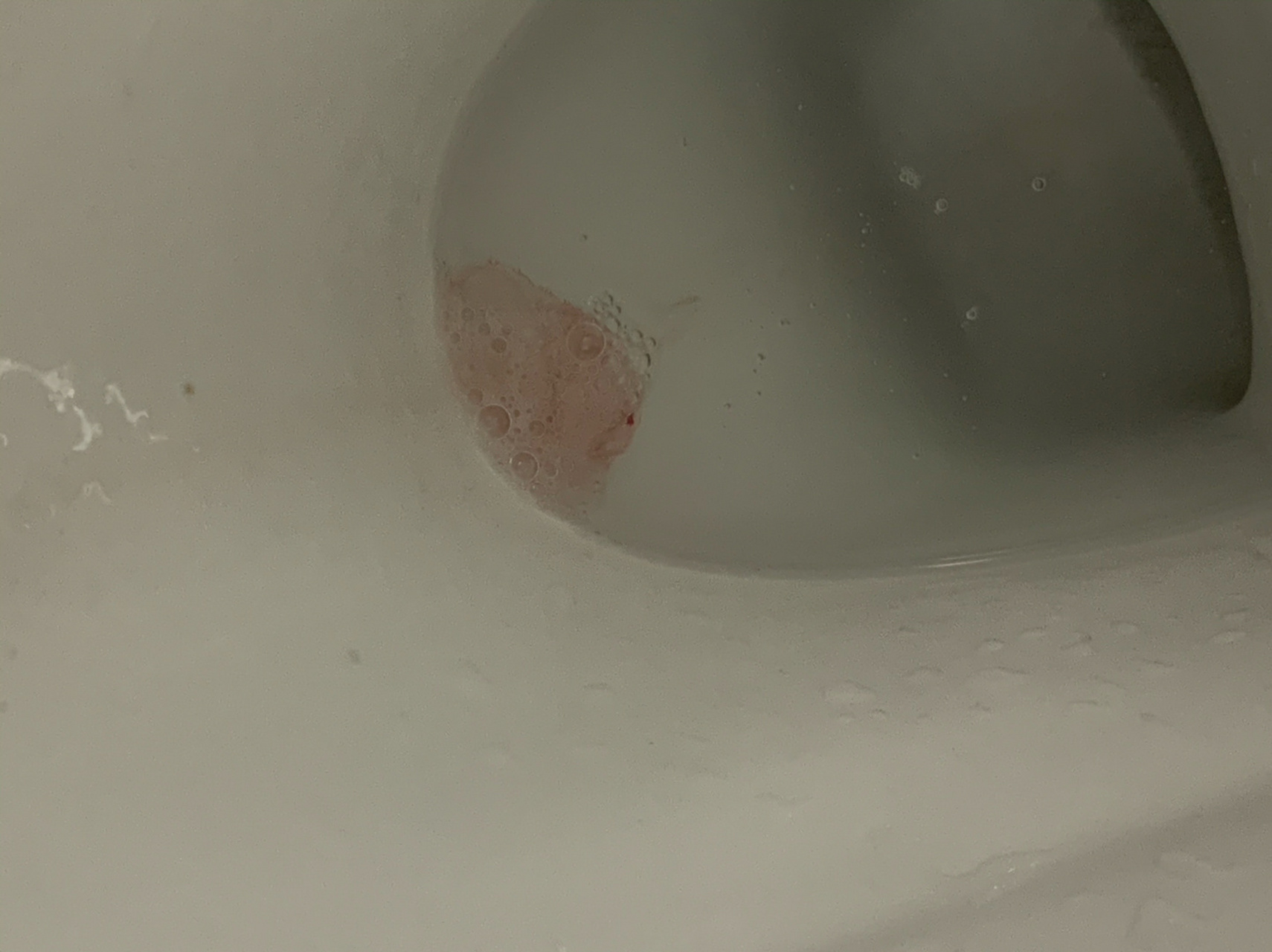吐到喉咙出血了怎么办 现在十周774,已经连续几天