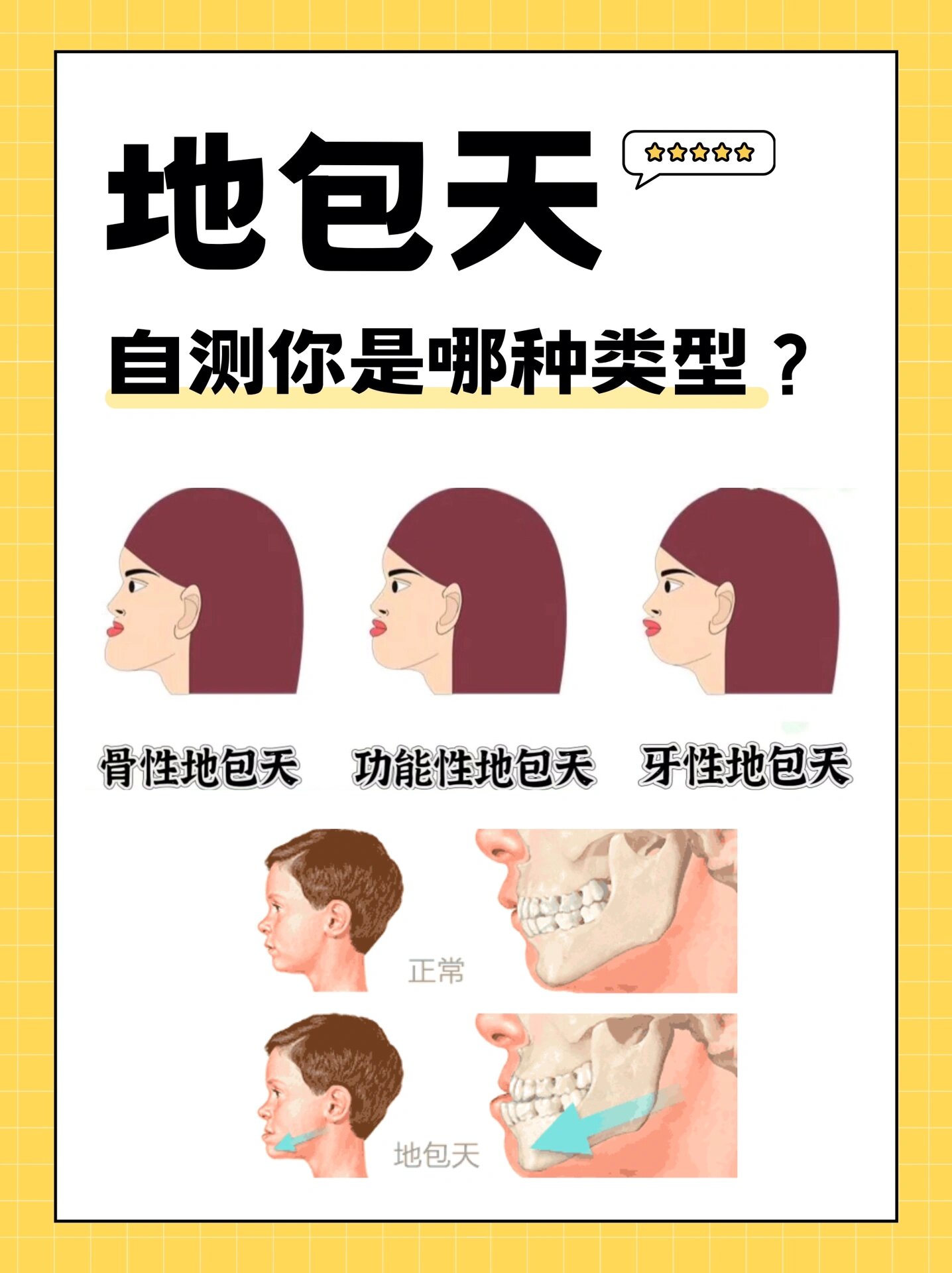 30秒自测地包天!看看你属于哪种