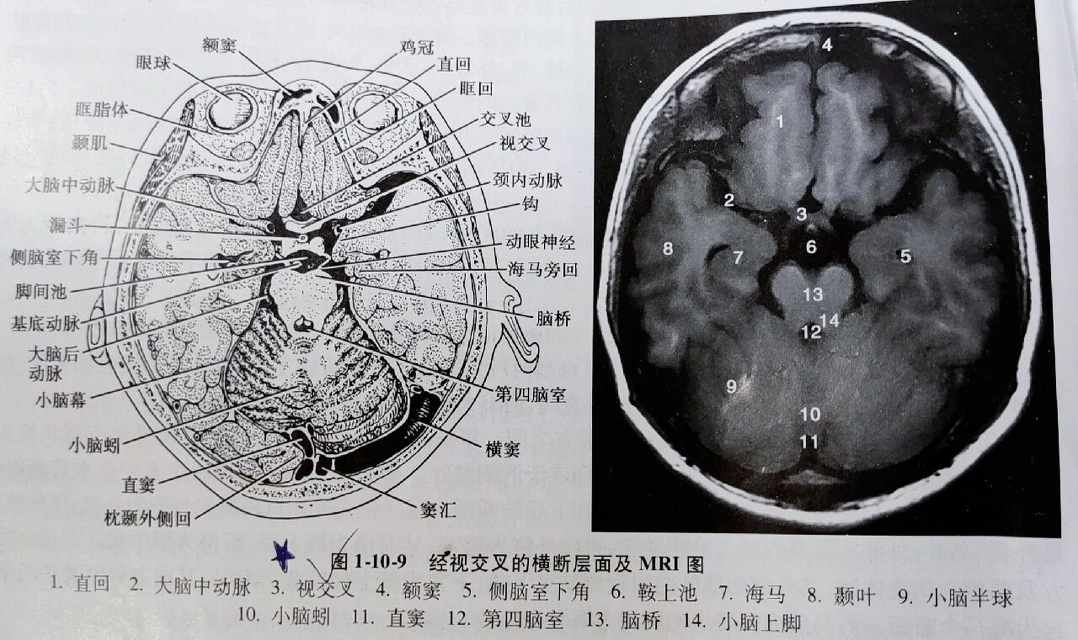 中央旁小叶解剖图图片