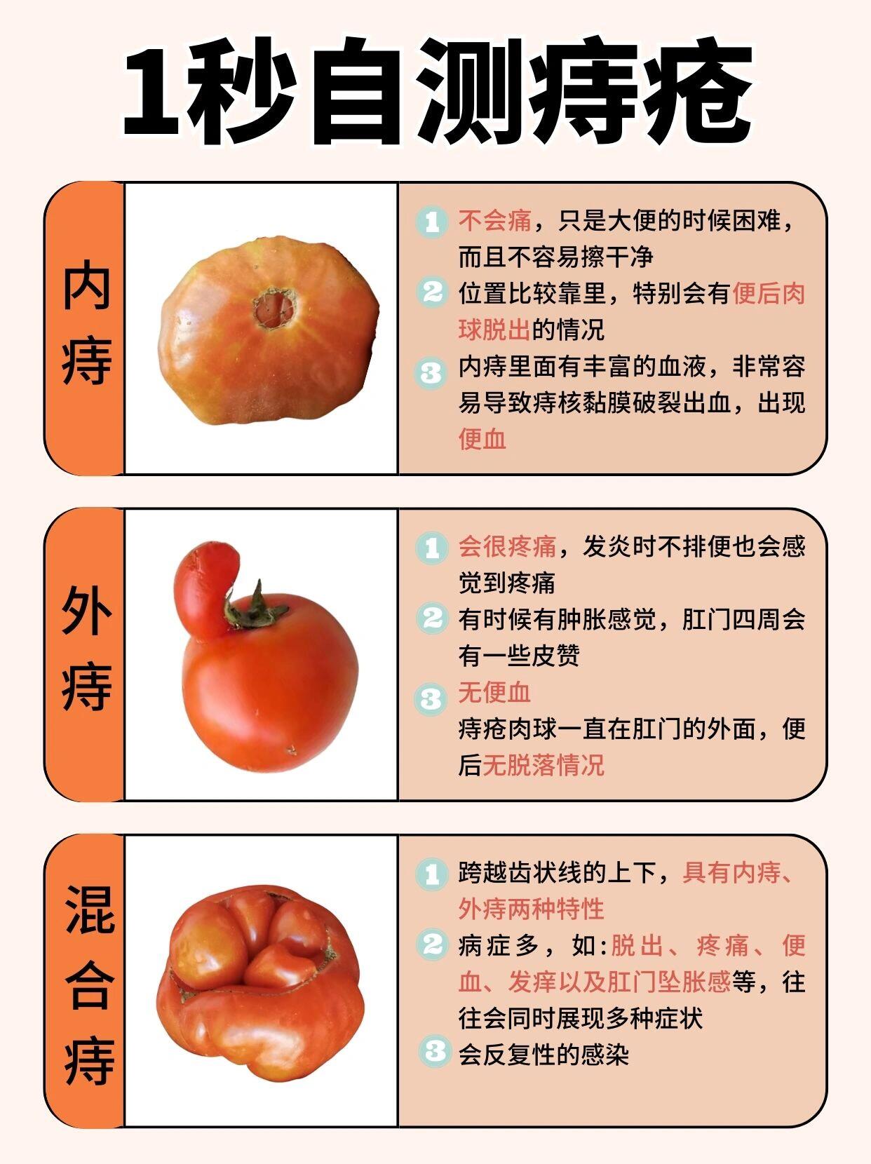 重度痔疮肉球党看过来 能帮一个是一个  好几年的痔疮经验真心分享给