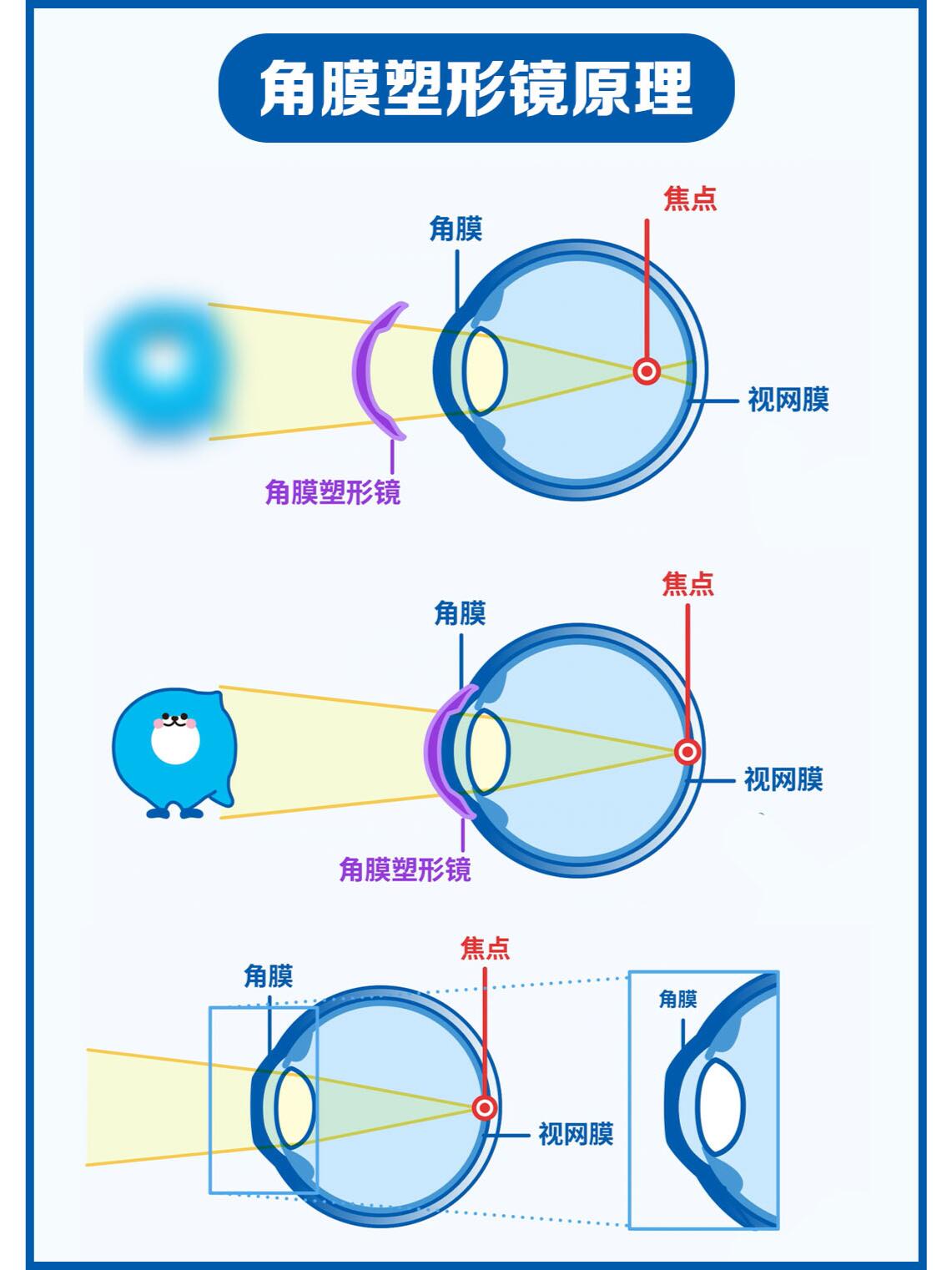 ok镜的原理及危害图片