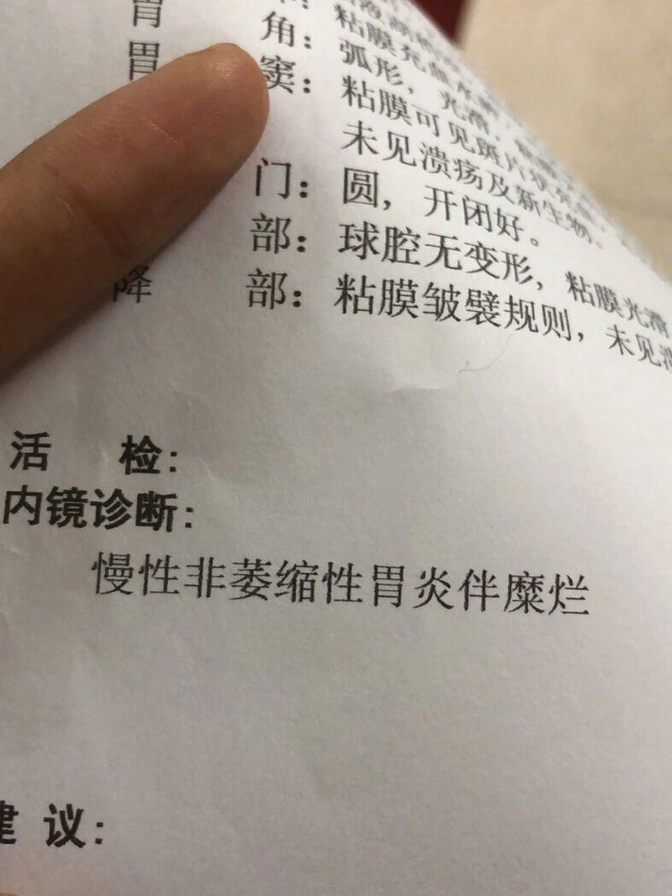 胃疼病例的照片图片