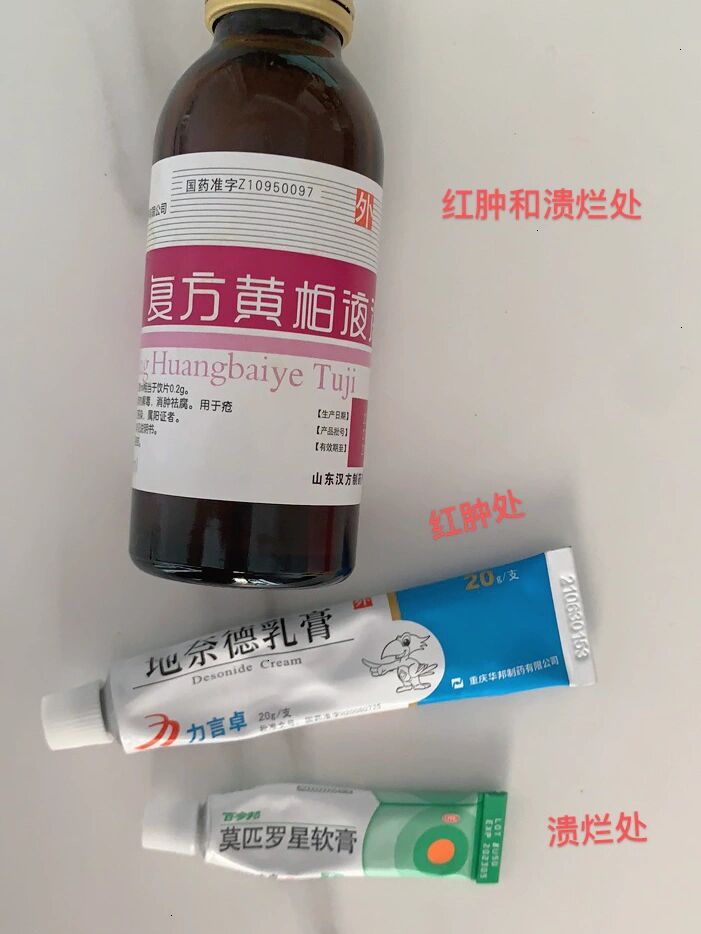 被隐翅虫咬的"神药"推荐