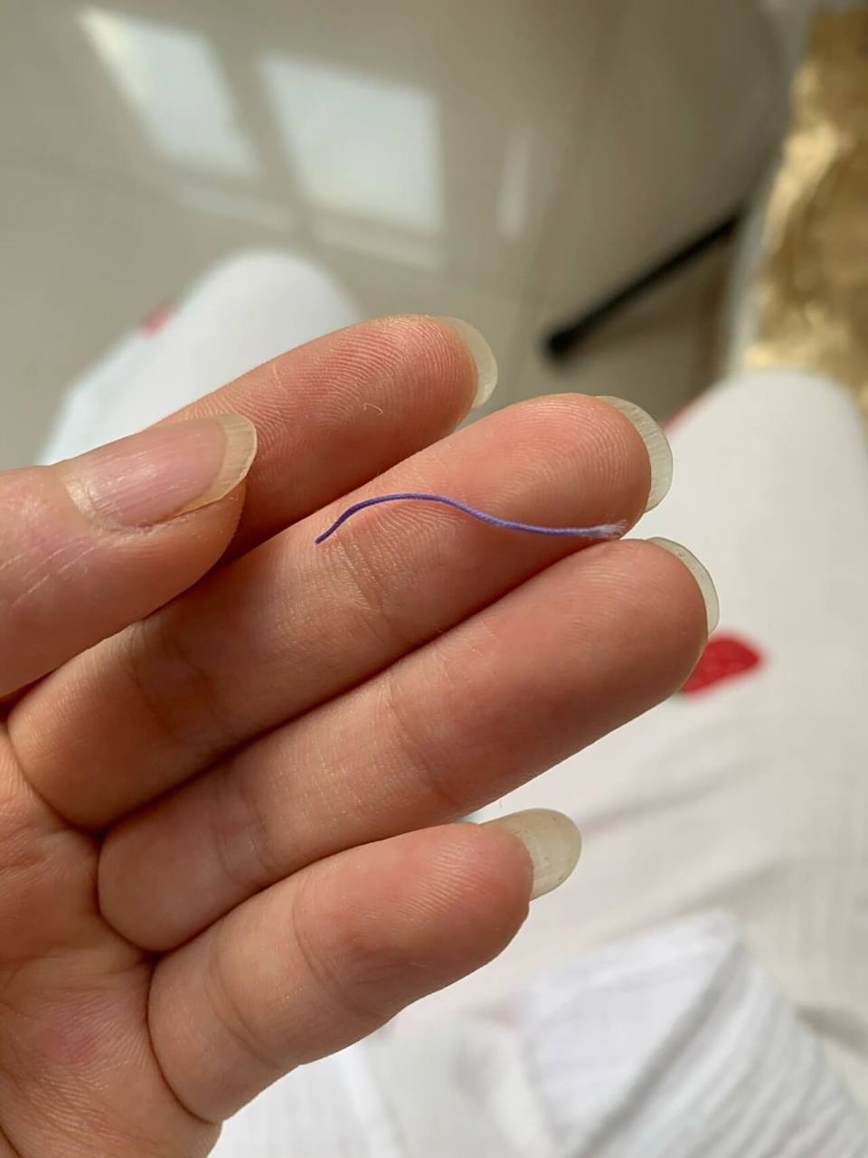 可吸收线是这样的吗?我的天?