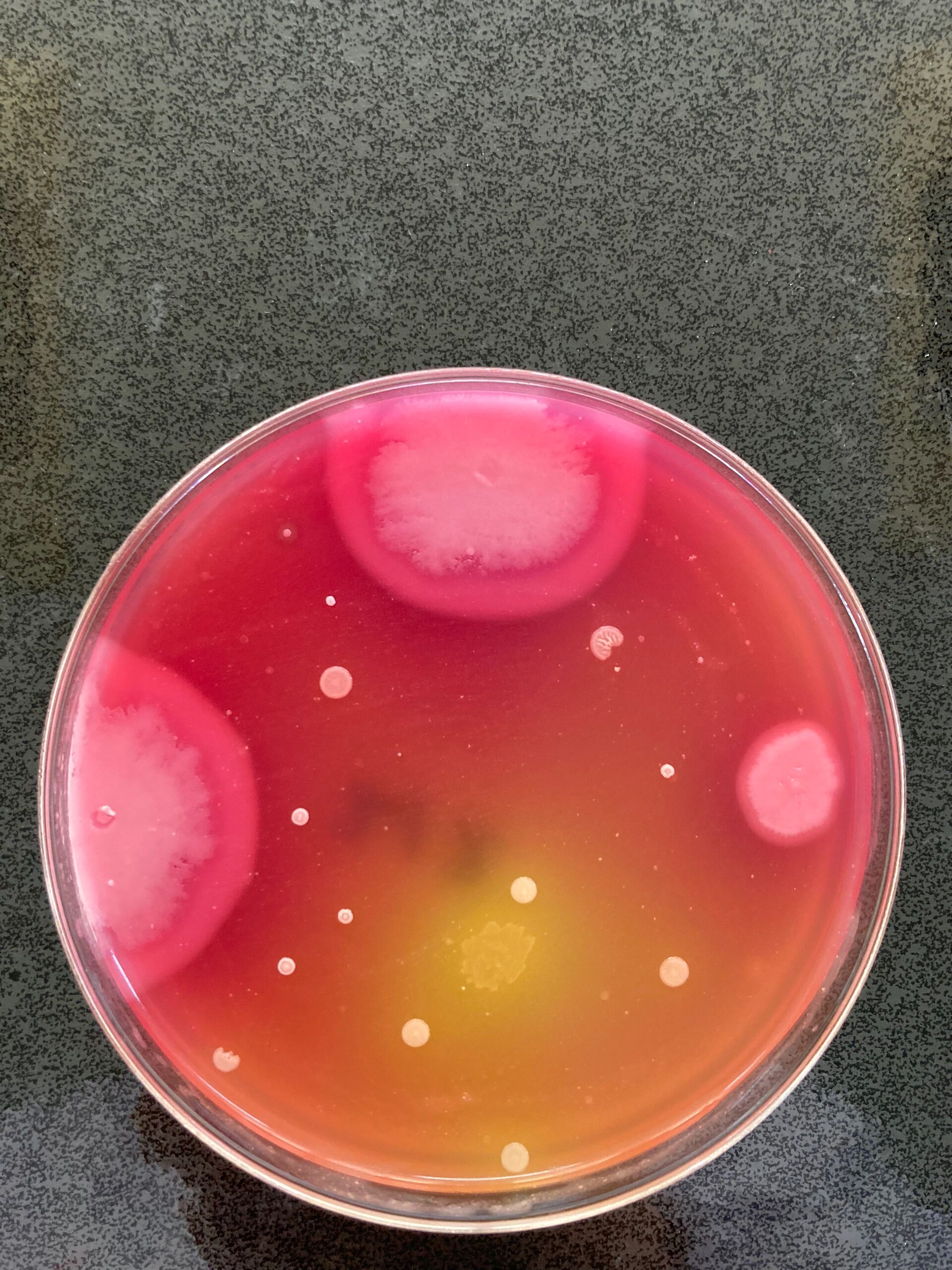 蜡样芽孢杆菌太美啦!疾控微生物🦠