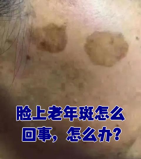 先说紫外线的问题,如果皮肤长期暴露在阳光下,紫外线会损伤皮肤,导致