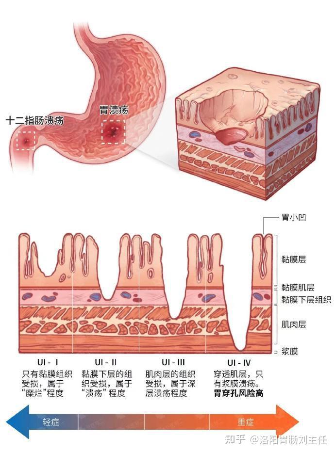 胃小凹结构图图片