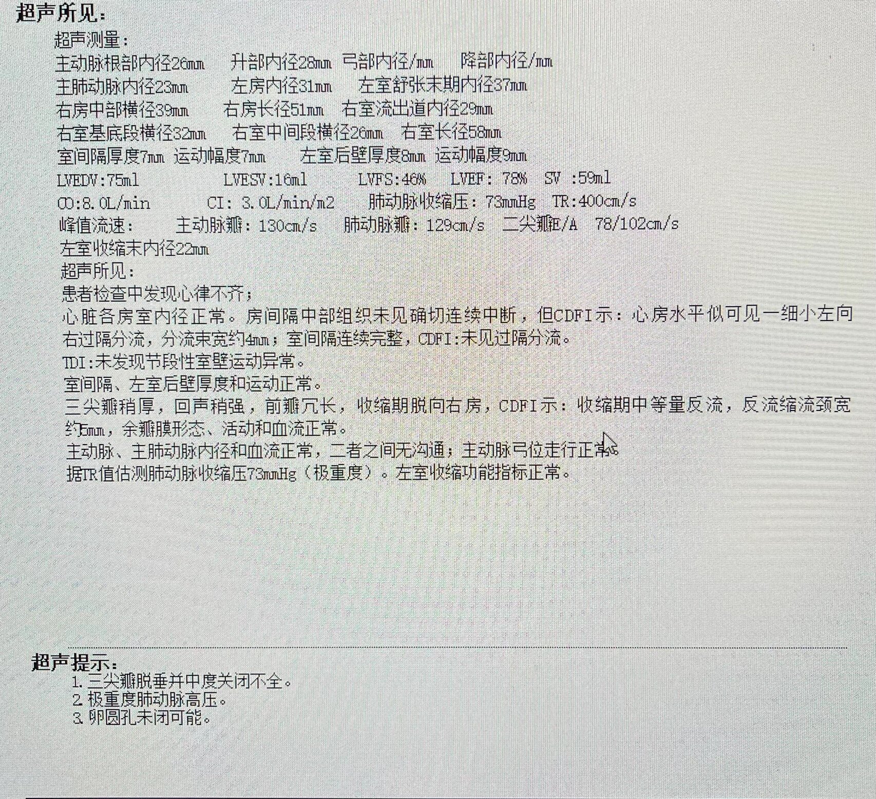 三尖瓣轻度关闭不全图片