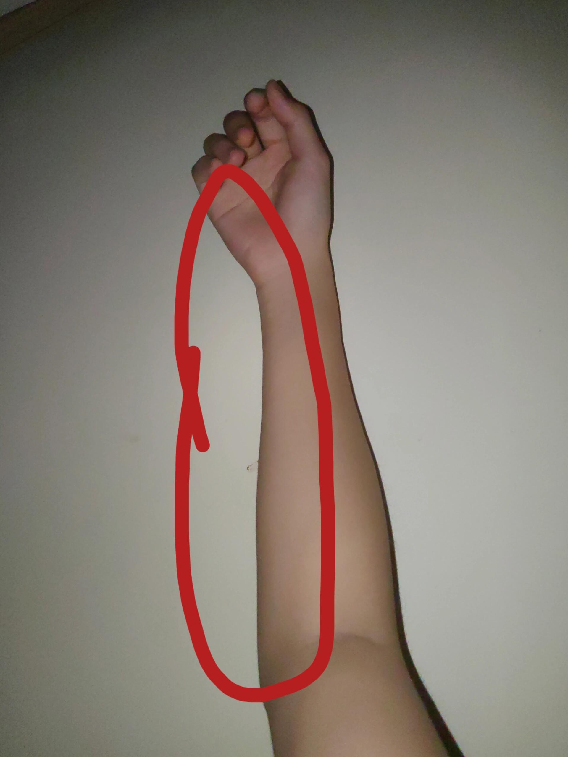 右臂疼的睡不着,我该不会得神经病了吧