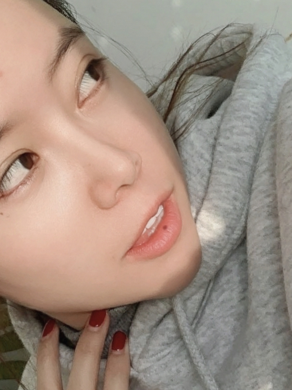 嘴唇痣 有人跟我一样下嘴唇中间长痣的吗?