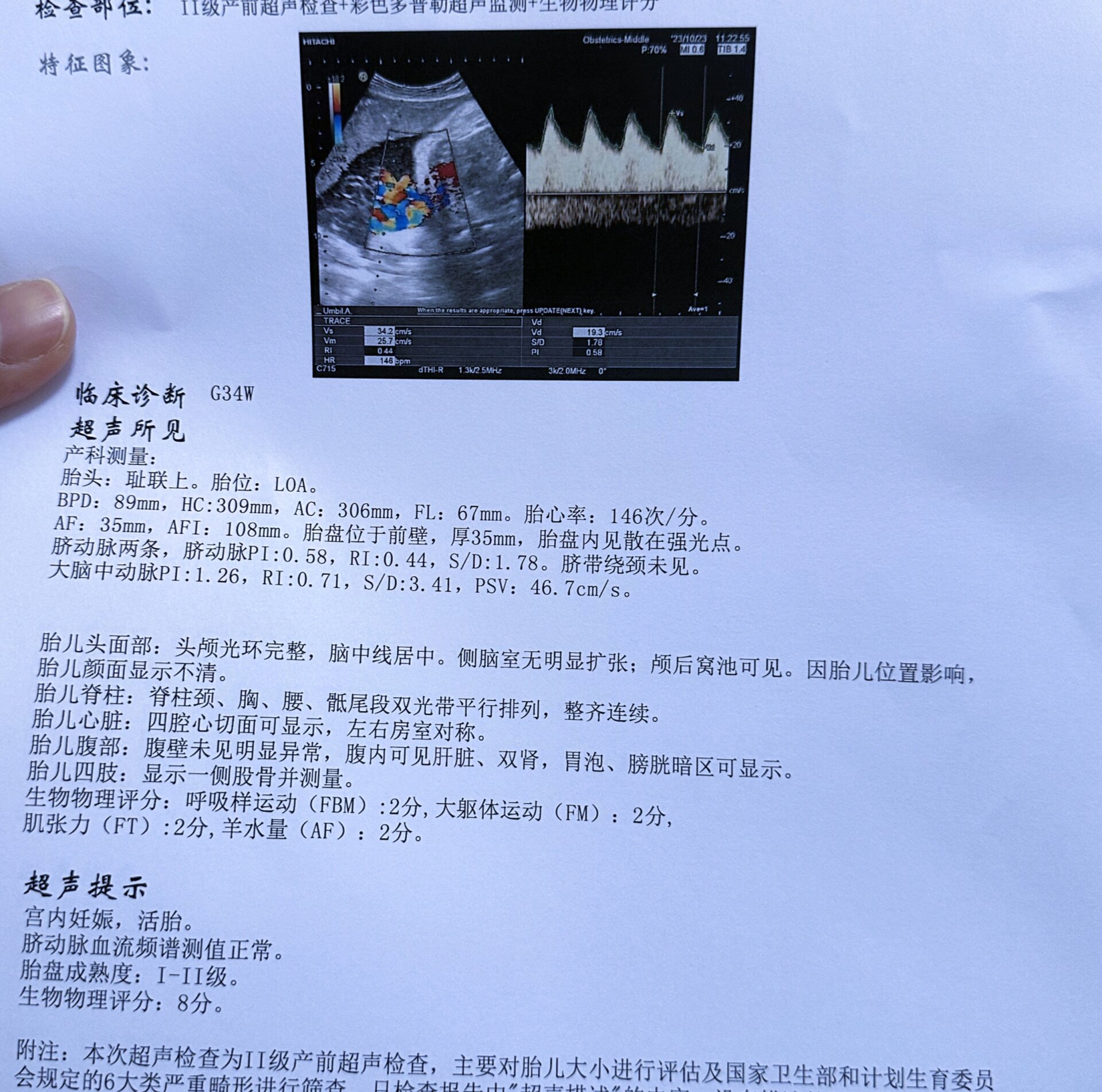 大脑中动脉pi值正常吗