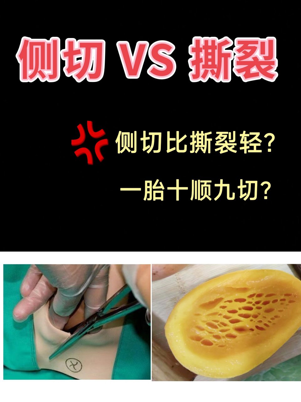 分娩照片撕裂图片