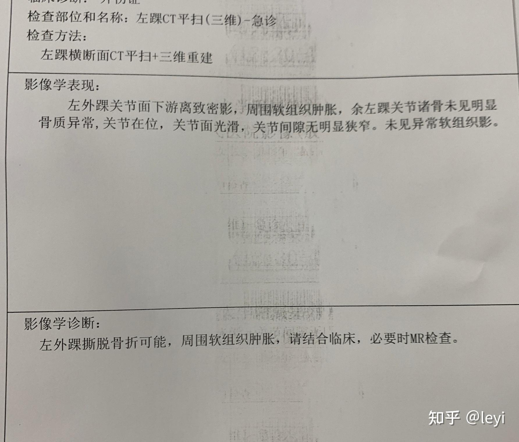 脚踝撕脱伤图片