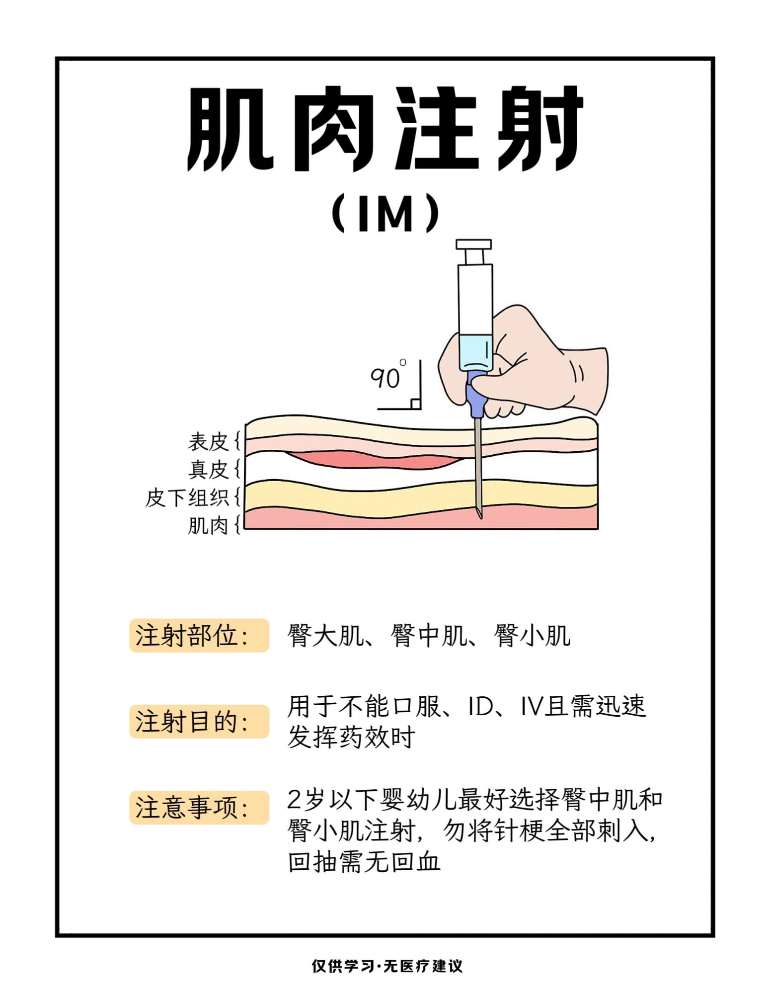 注射器部位图解图片