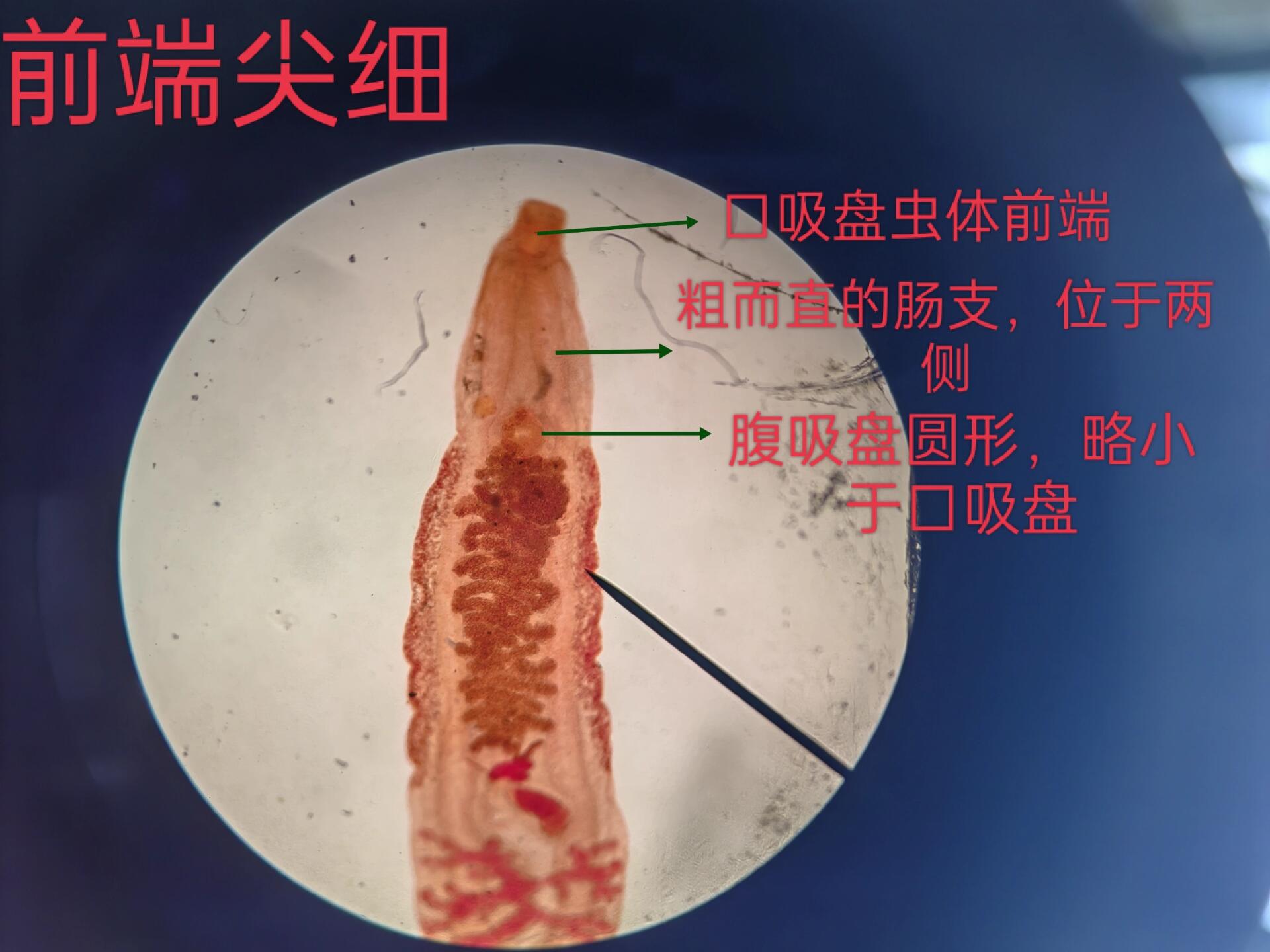 华支睾吸虫成虫手绘图图片