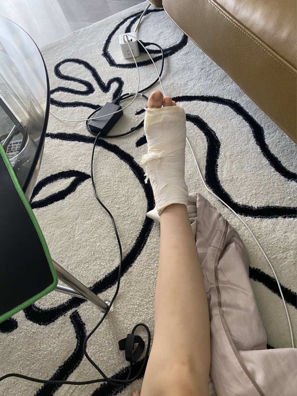 骨折日记|跖骨骨折第21天 记录一下,小腿细到人生巅峰