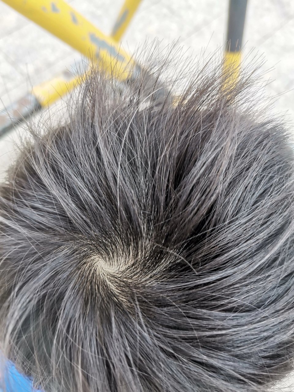 四岁宝宝有一根白头发 小时候是金黄色的 现在变成白色了 只有一个根