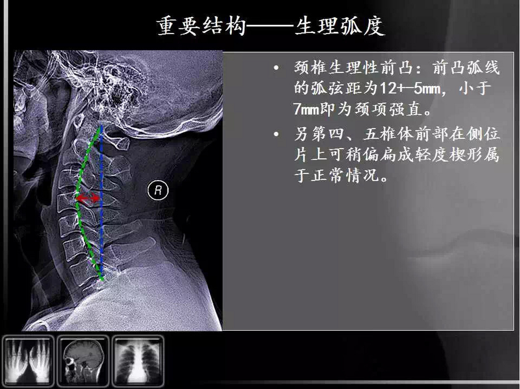 颈椎DR解剖图片