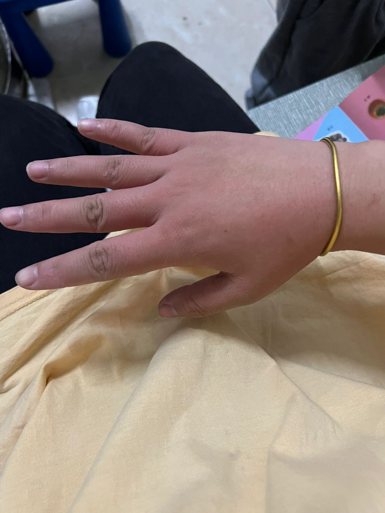 芋头过敏 就削了个芋头 就痒的不行了 恨不得剁手了要 涂了蚊虫止痒棒