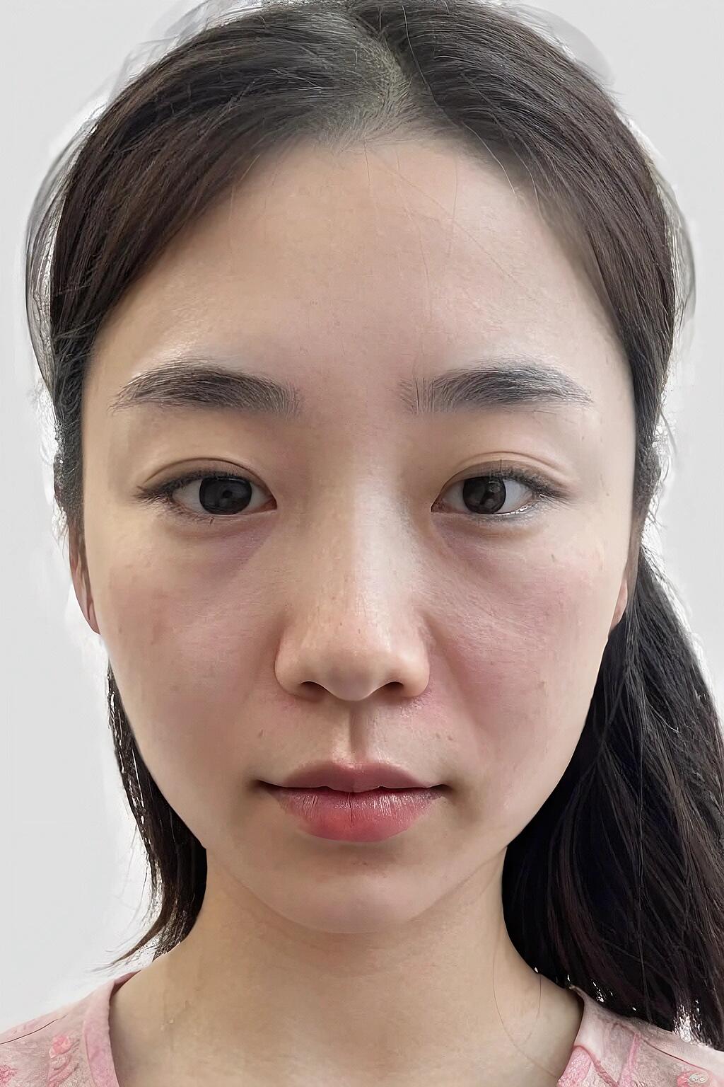 鼻综合手术能解决哪些问题