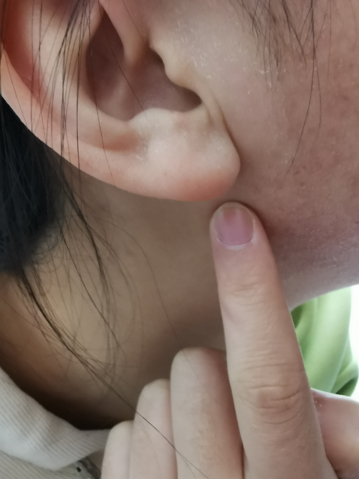 18岁耳垂下皮里摸到淋巴结肿大几个不消