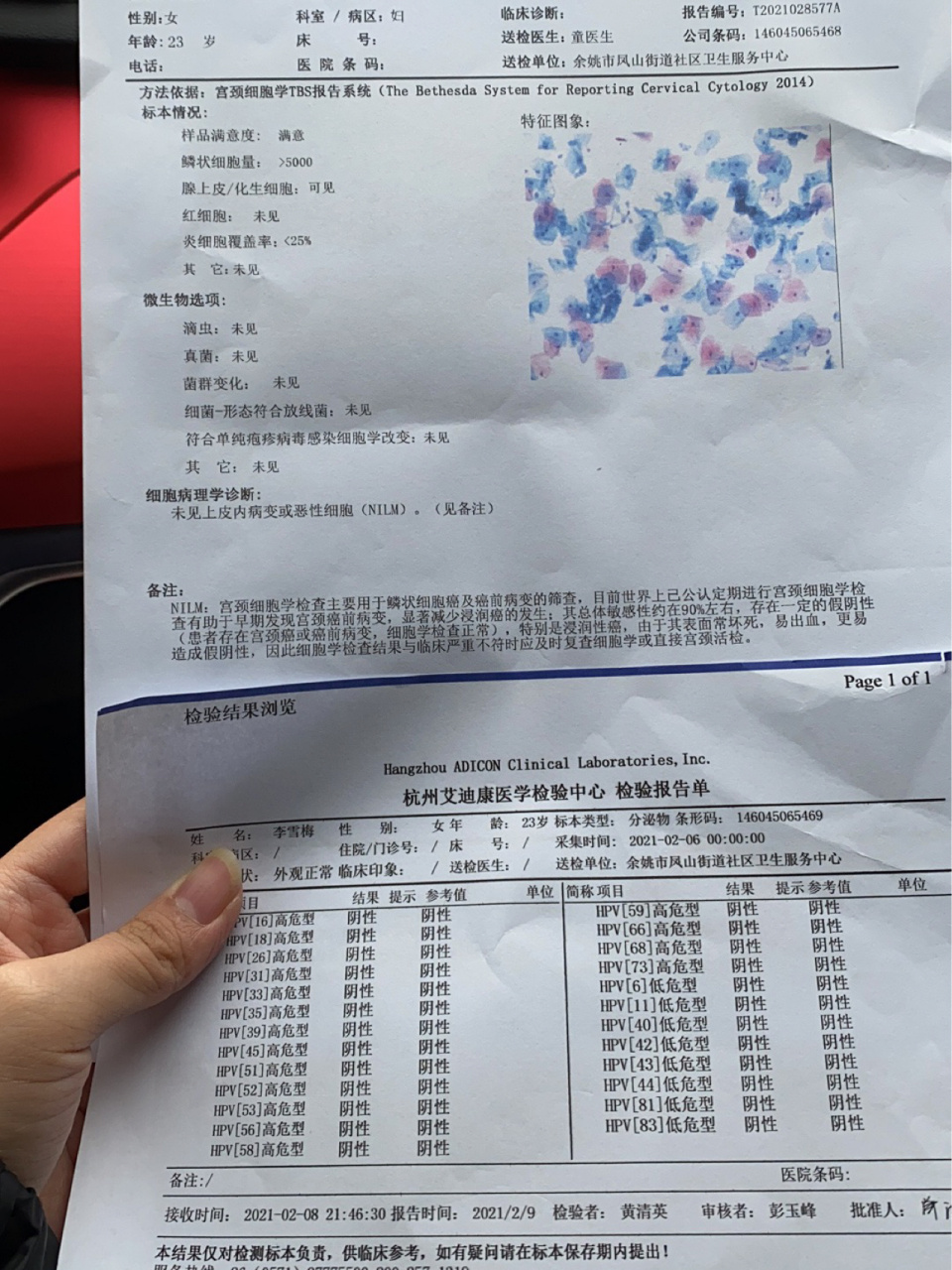 身边的人都在做宫颈刮片,我也跟风做了一次宫颈刮片,全程不是很疼,有
