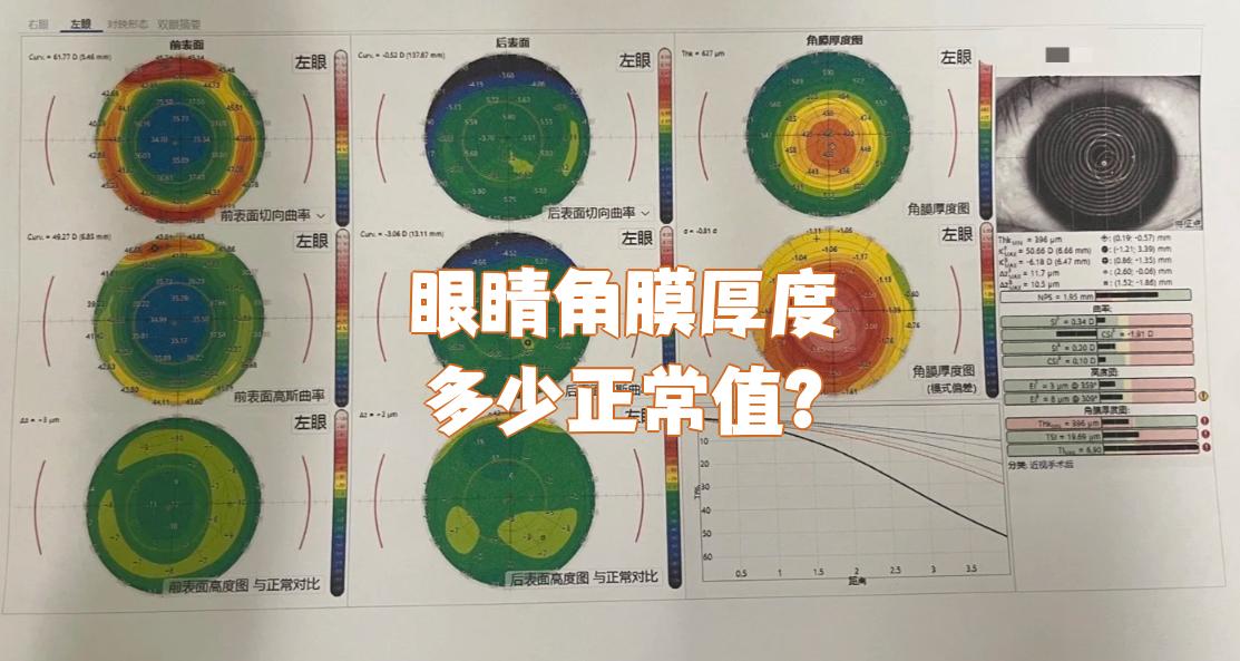 眼睛角膜厚度多少正常值?