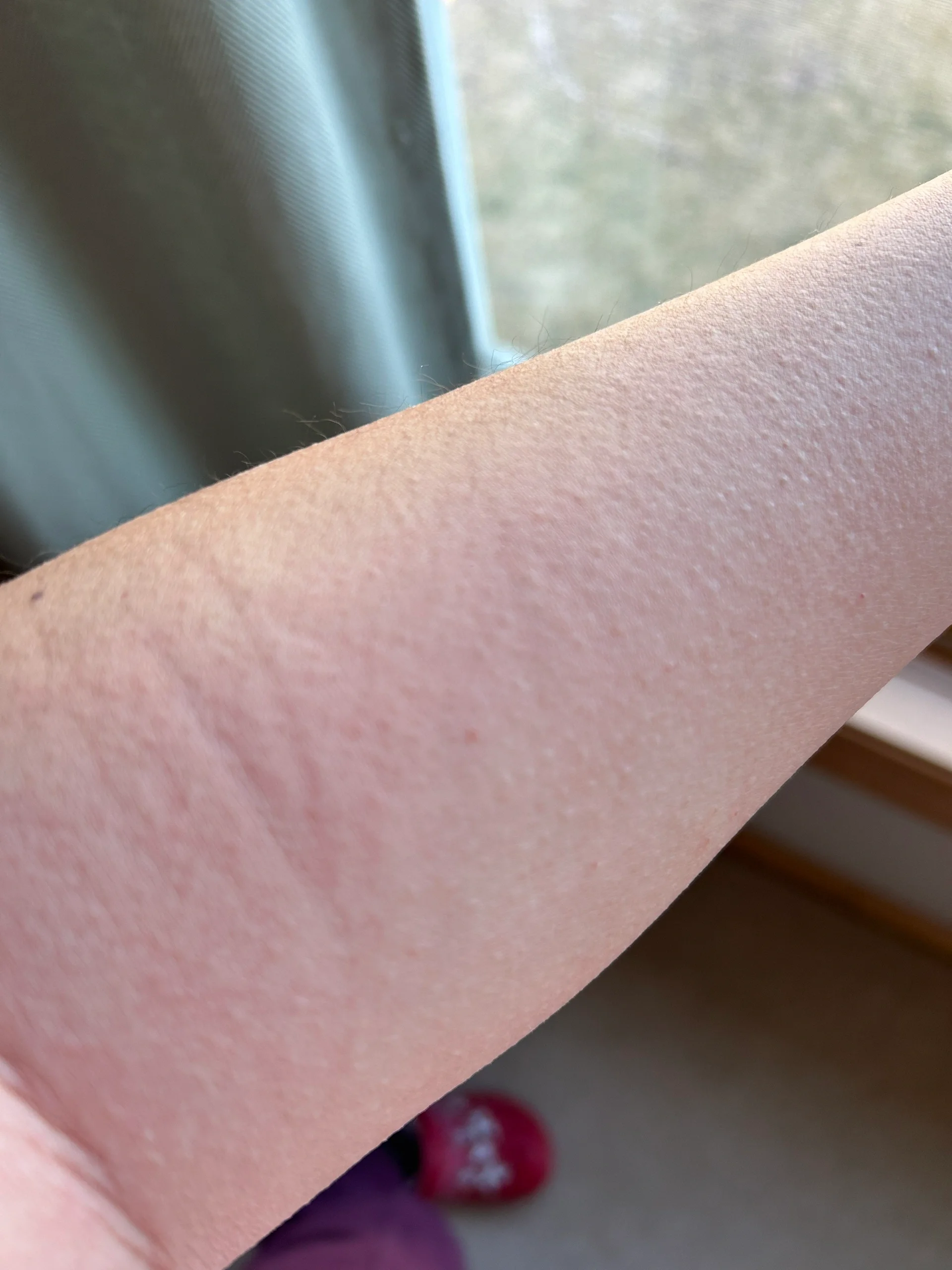 家人们谁懂啊[捂脸] 随便买的沐浴露 洗完澡全身浮肿红痒 胳膊粗了一