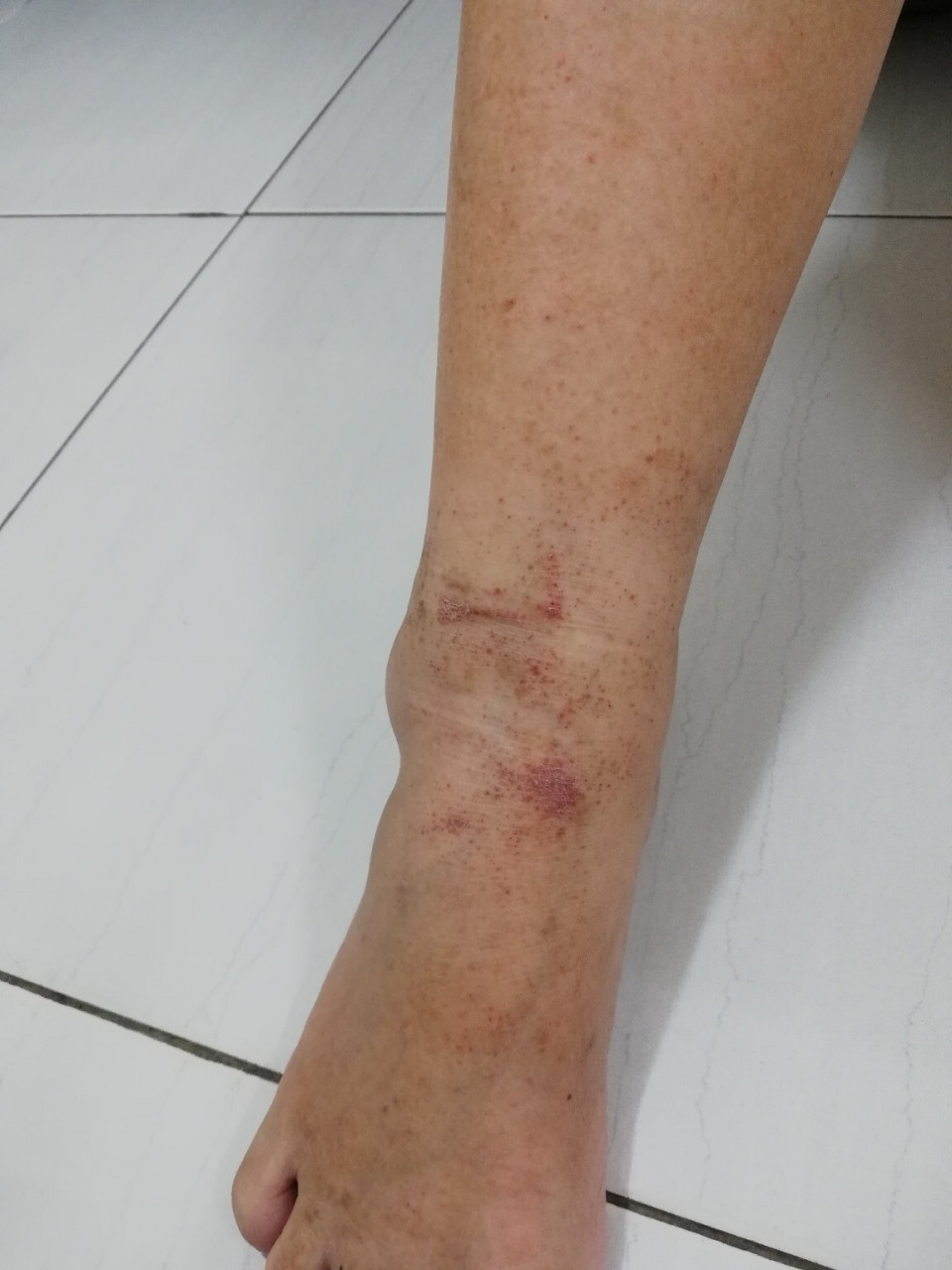 怎么会这样呢?不痛不痒的细小红点越来越多谁能帮我解答01