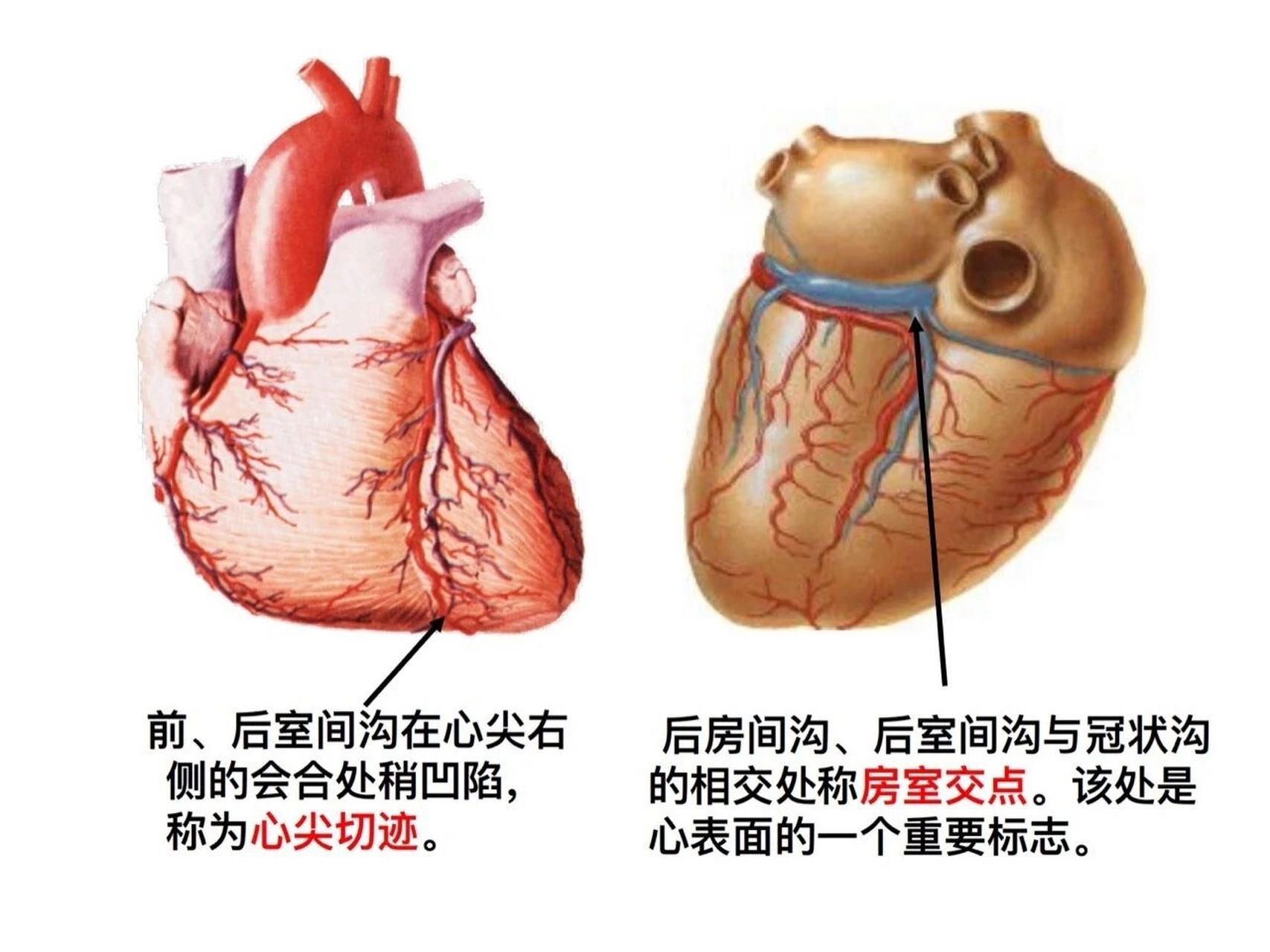 心室图解图片