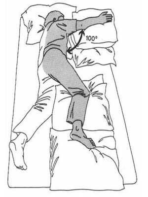 脑梗患者在偏瘫后,时常感到疼痛,肌张力高,手打不开, 胳膊变成折刀状