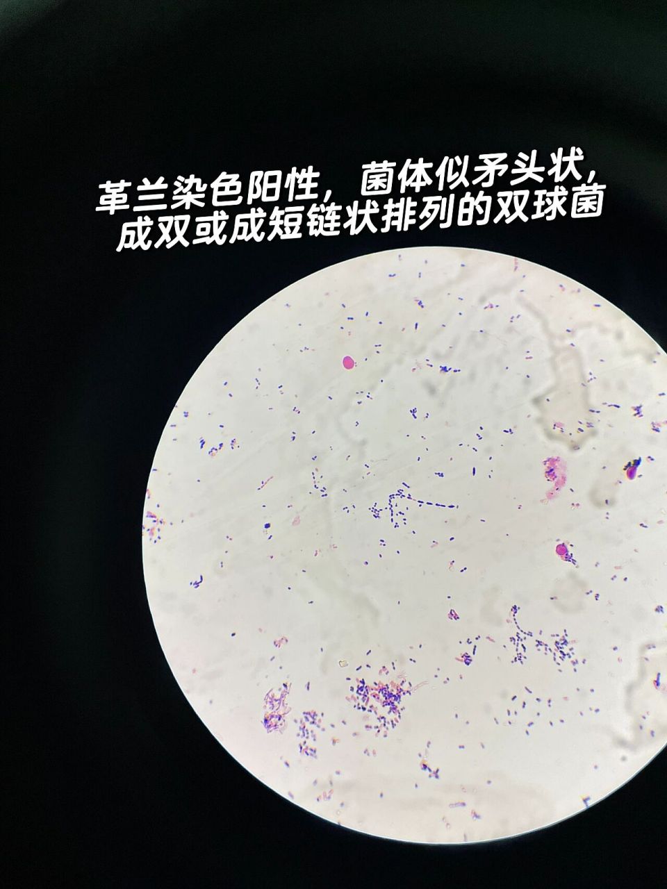 链球菌革兰氏染色绘图图片
