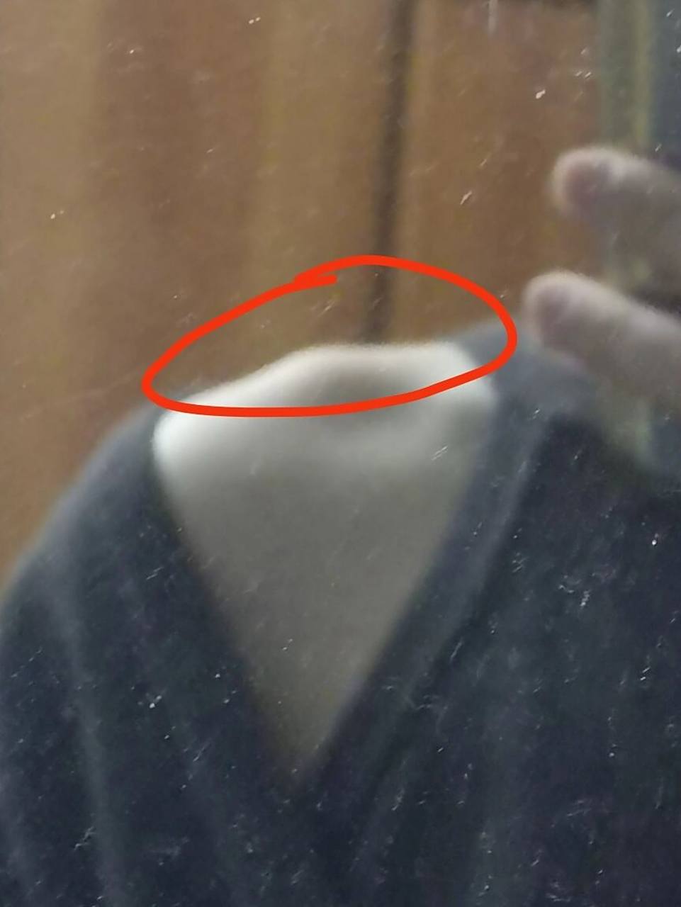 肩膀上有个凸起的骨头 各位美女们 你们肩膀上也会有个这个骨头吗