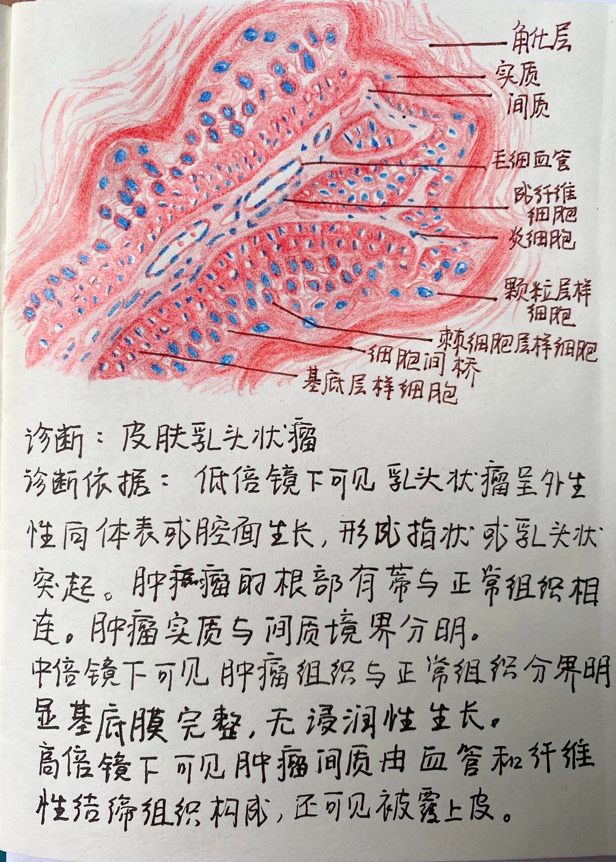 肿瘤/心血管/泌尿 病理绘图 1皮肤乳头状瘤 2鳞状细胞癌 3风湿性心肌