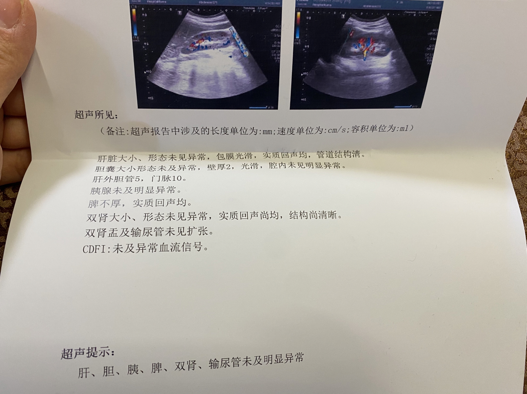 肝囊肿消失