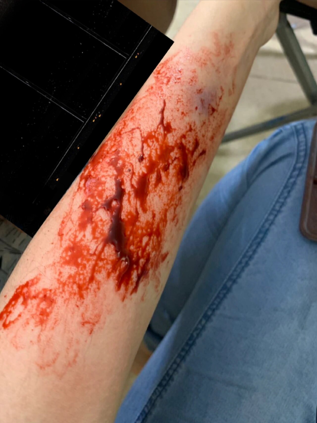 这是真血还是假血?