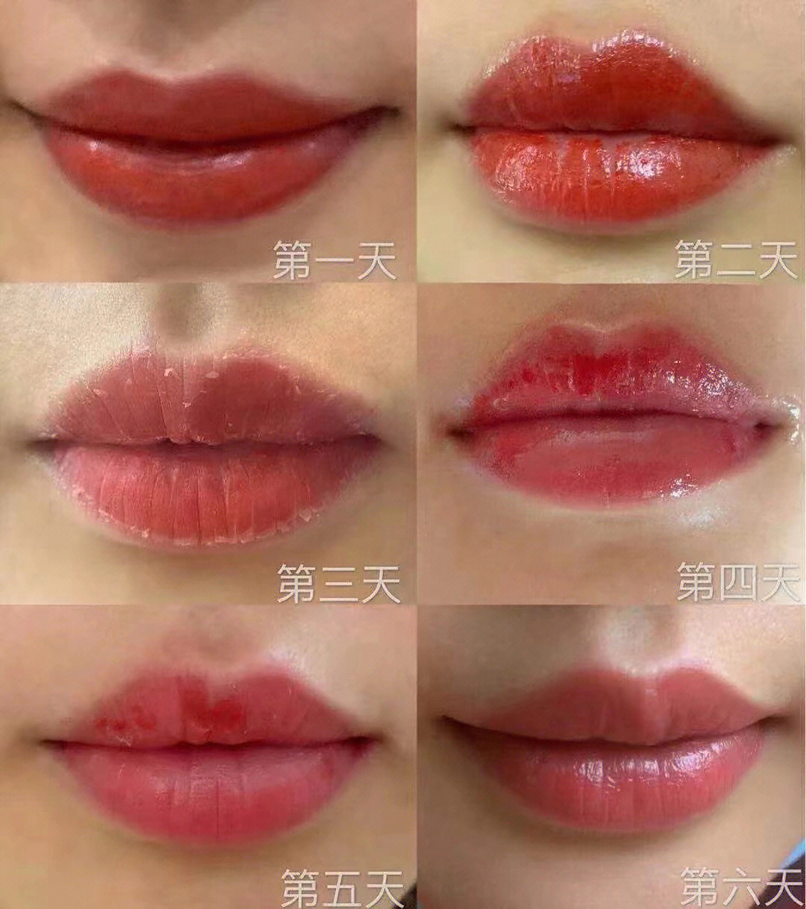 唇色后的修复过程 我的漂唇记录97我原本唇色偏淡,没化妆都很惨白