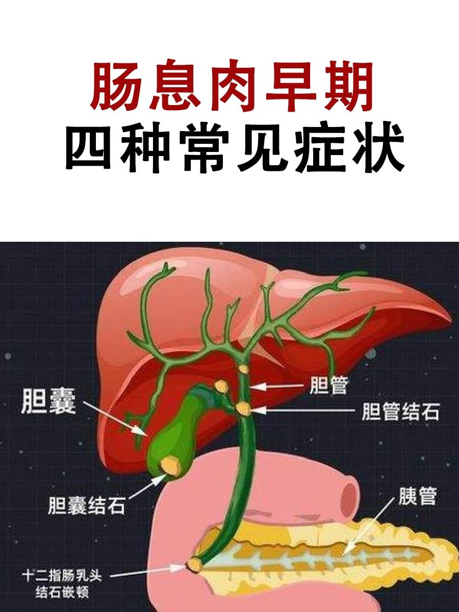 肠息肉有什么症状图片