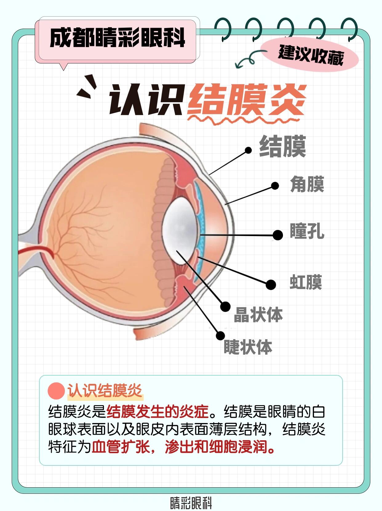 结膜炎会传染吗图片