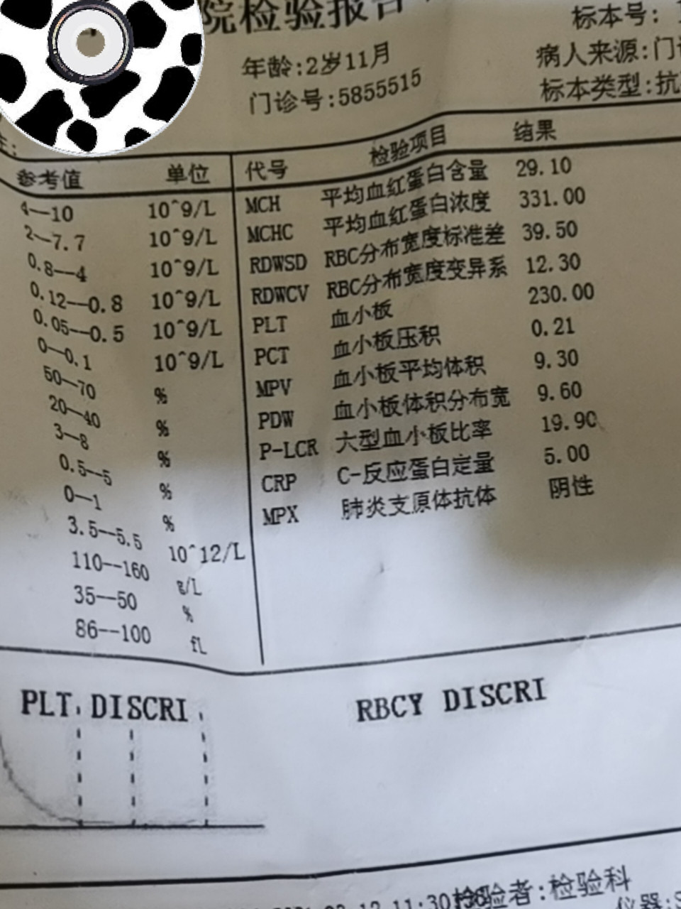 宝宝扁桃体化脓反复高烧40℃三天三夜 宝宝三岁3