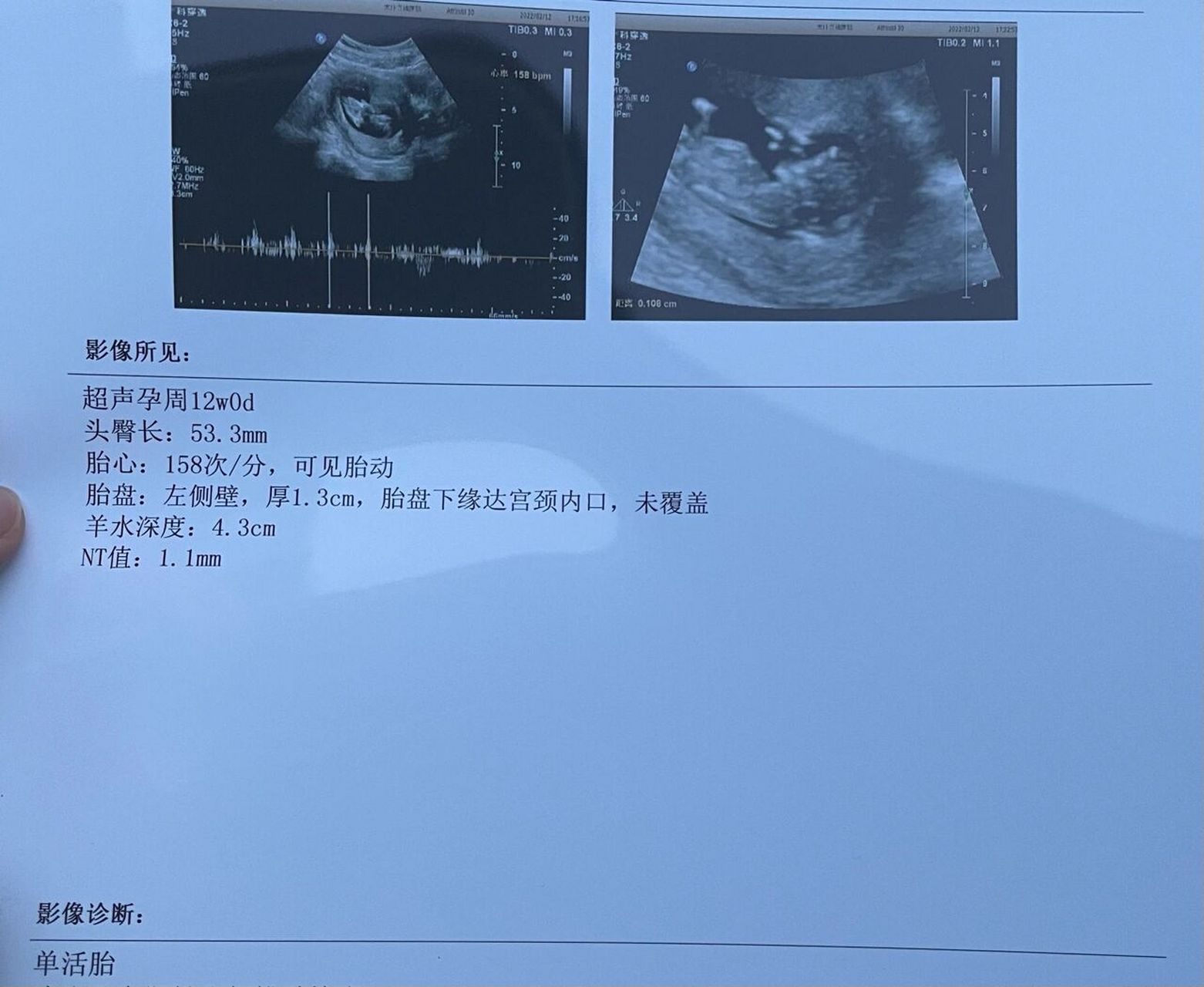 nt看男女 有没有懂得小姐妹给看下