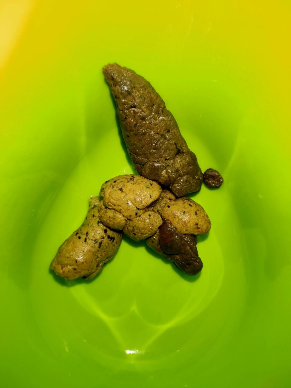 5克小麦纤维素,现在两天一次 减药期间,排便时间有