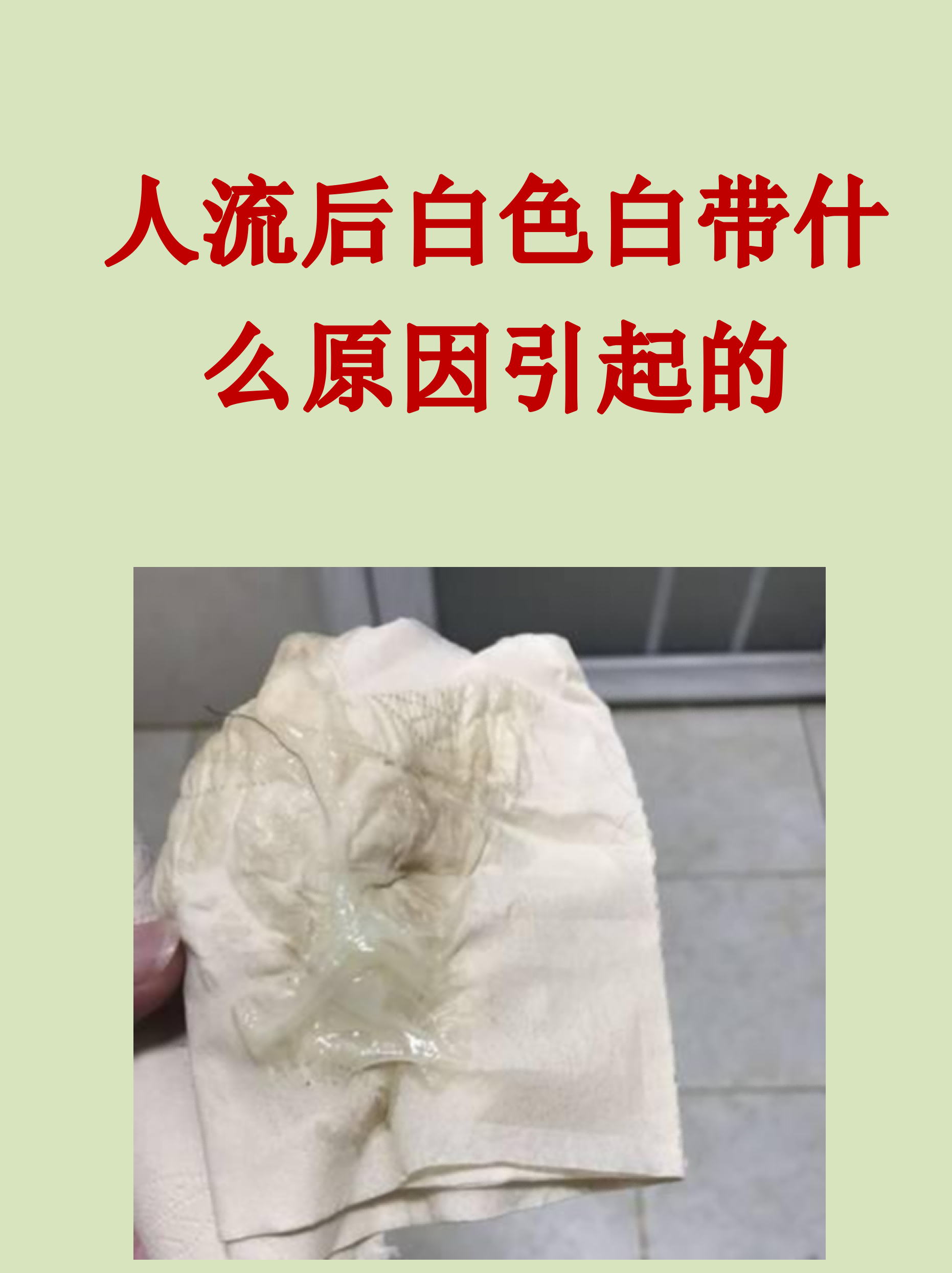 人流后白色白带什么原因引起的