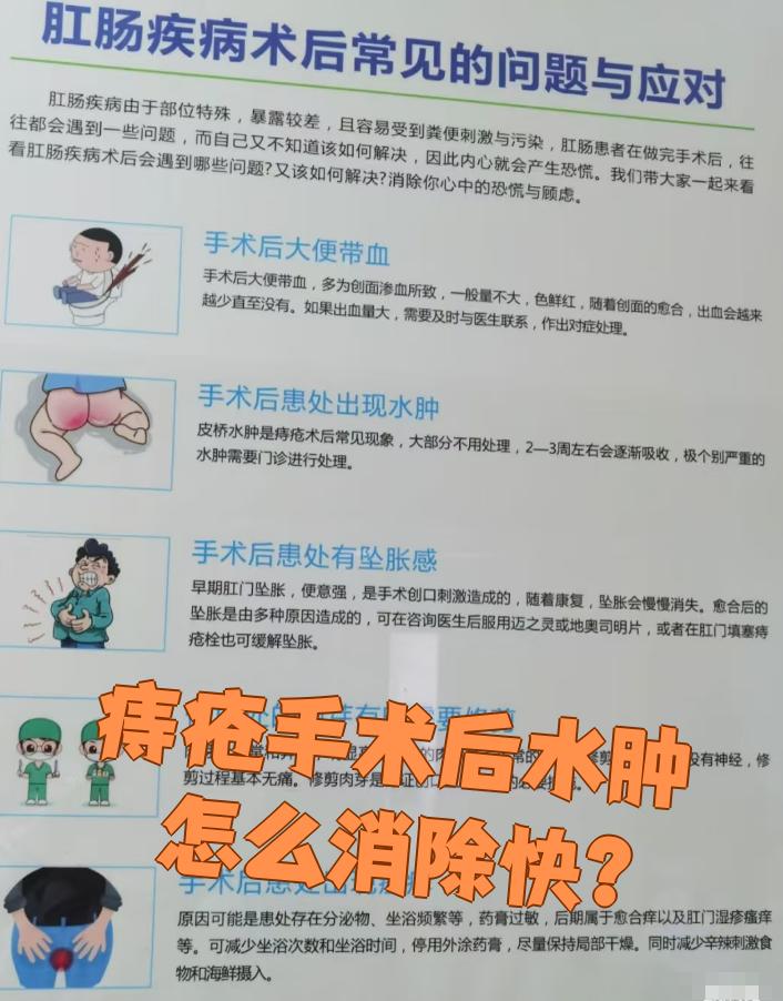 痔疮手术后为什么水肿
